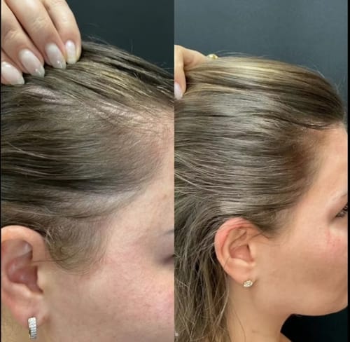 Gélules d’huile de pépins de courge