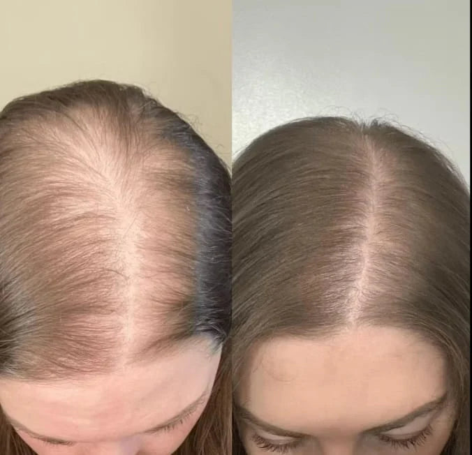 Gélules d’huile de pépins de courge